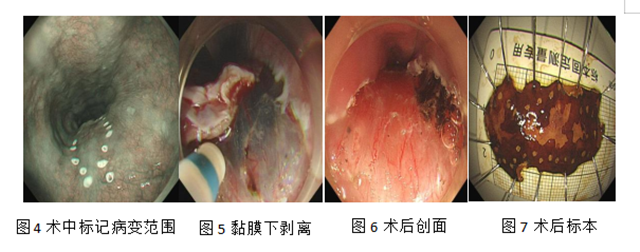 消化2_副本.png