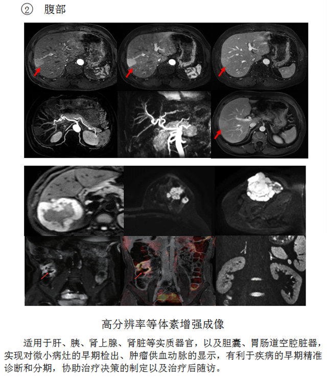 核磁5_副本.png