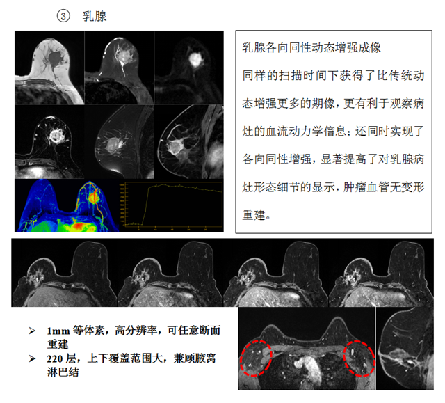 核磁8_副本.png