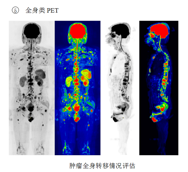 核磁10_副本.png