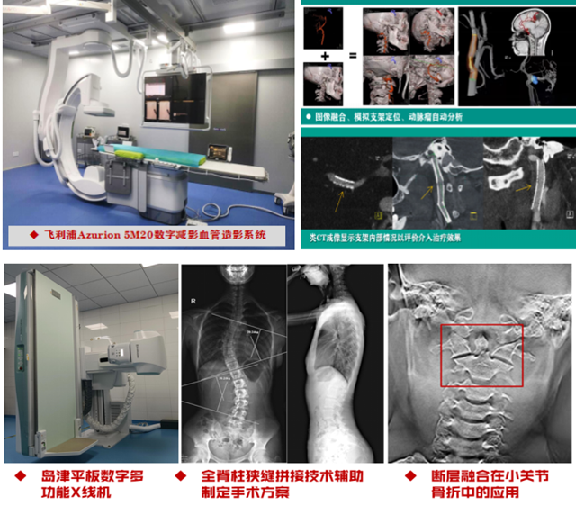 血管造影系統(tǒng)_副本.png